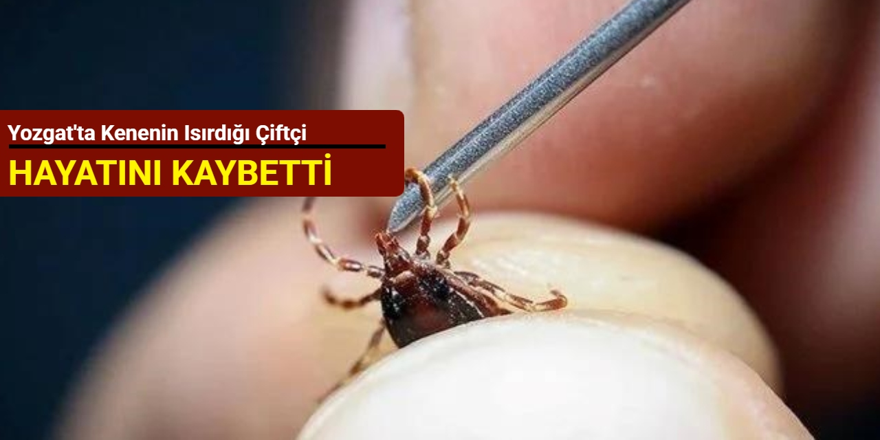 Yozgat'ta kenenin ısırdığı çiftçi hayatını kaybetti