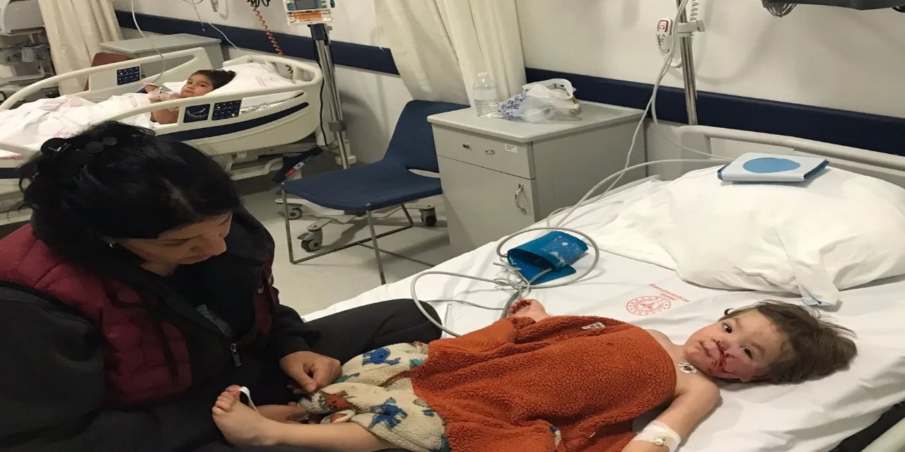 Ankara'da bir çocuğa Pitbull saldırdı: Çocuğun yüzü paramparça oldu