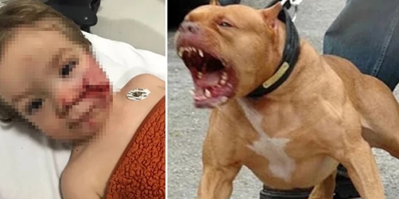 Ankara'da pitbull cinsi köpeğin saldırısına uğrayan 2 çocuk yaralandı