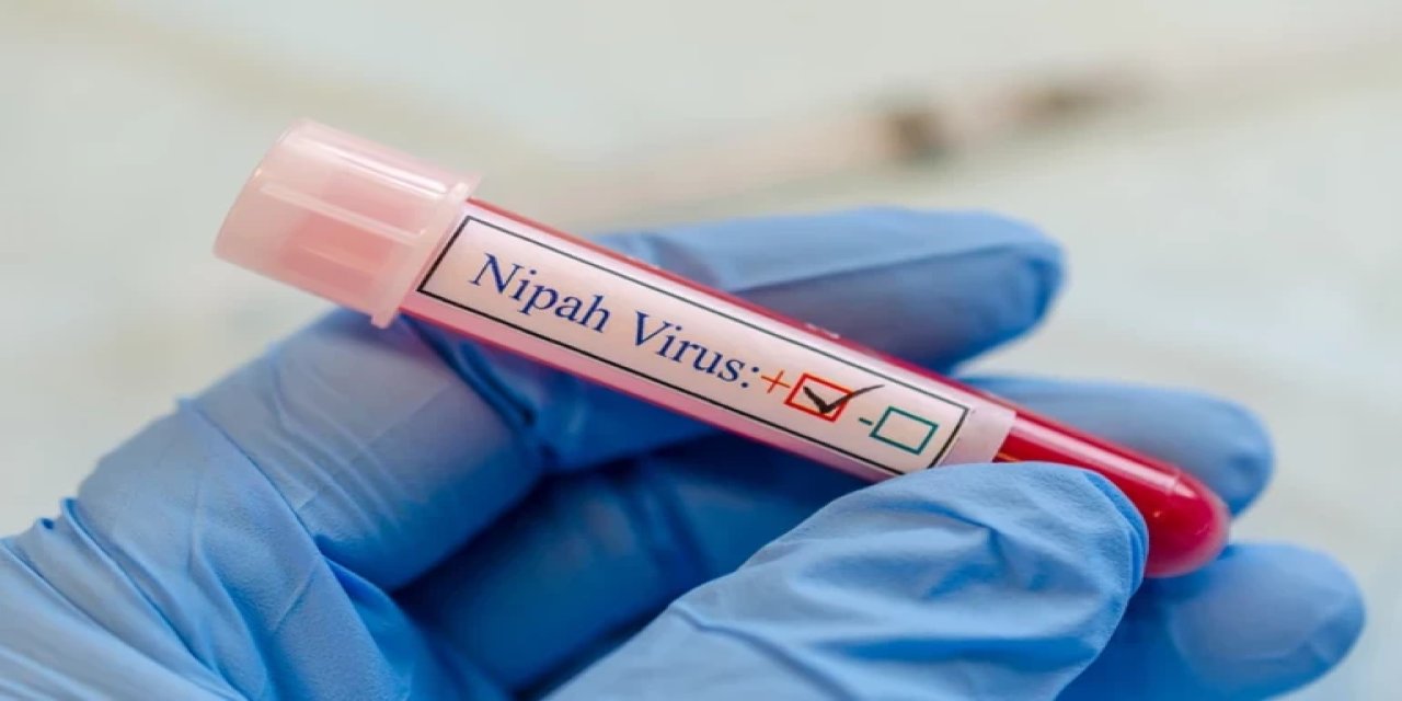 İşte Nipah virüsü belirtileri ve bulaşma yolları