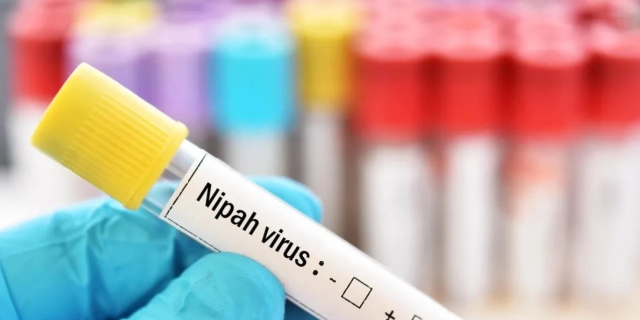 DSÖ'den dünyayı tedirgin eden Nipah virüsü açıklaması