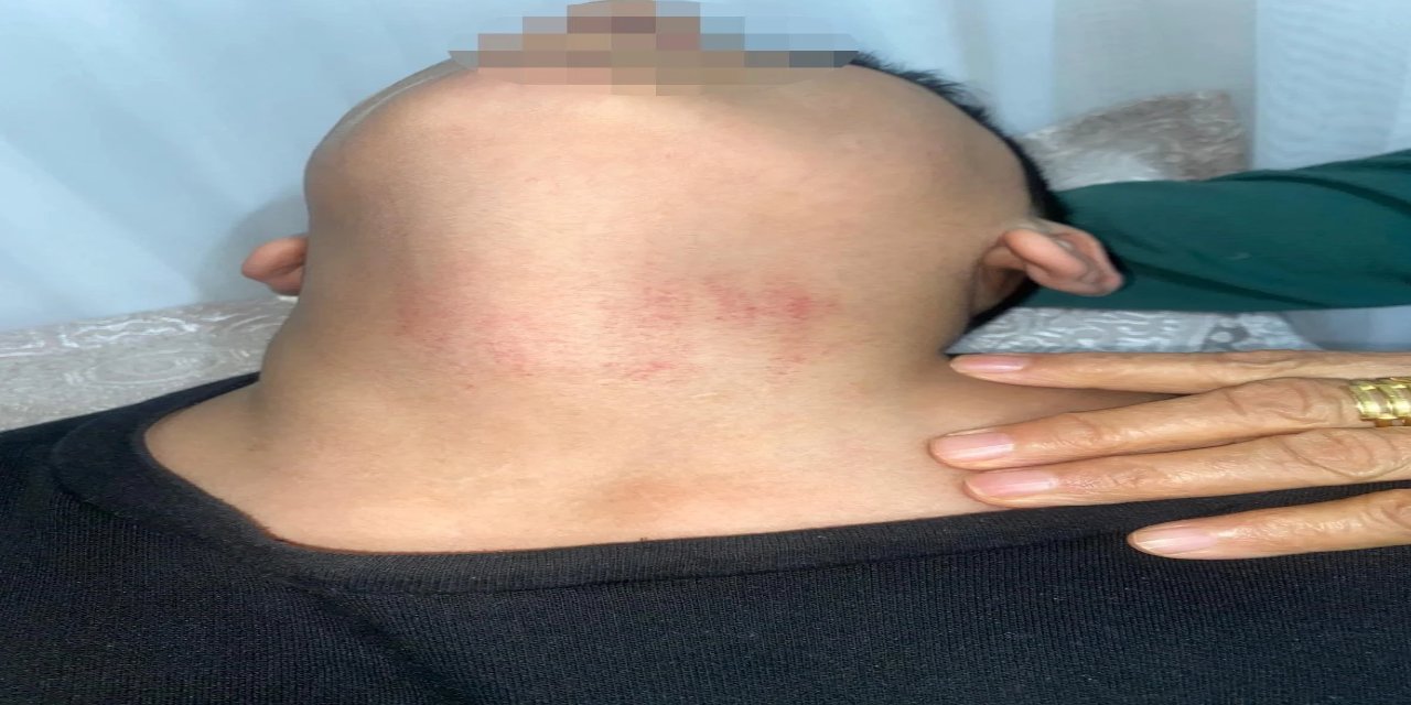 İstanbul'da kadın memur 10 yaşındaki öğrenciyi darp etti